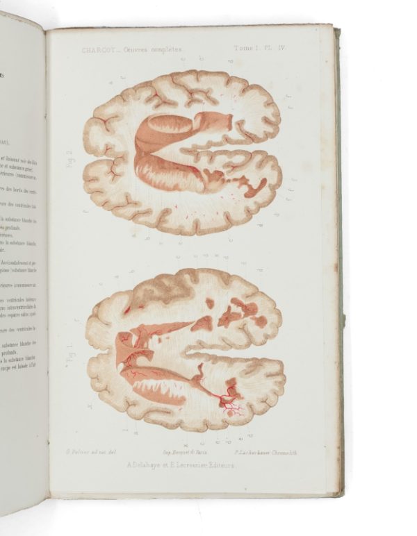 <span class="artist-name-product">CHARCOT Jean-Martin</span> Oeuvres complètes. Recueillies et publiées par Bourneville. - Image 3