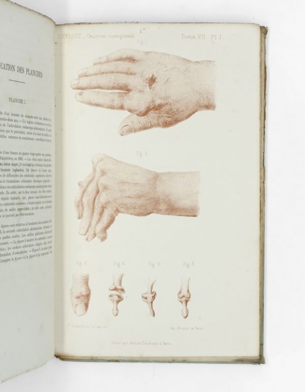 <span class="artist-name-product">CHARCOT Jean-Martin</span> Oeuvres complètes. Recueillies et publiées par Bourneville. - Image 4